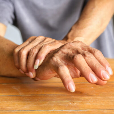 Ways To Manage Psoriatic Arthritis With Lifestyle Changes